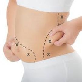 YouPic profile picture for @liposuction